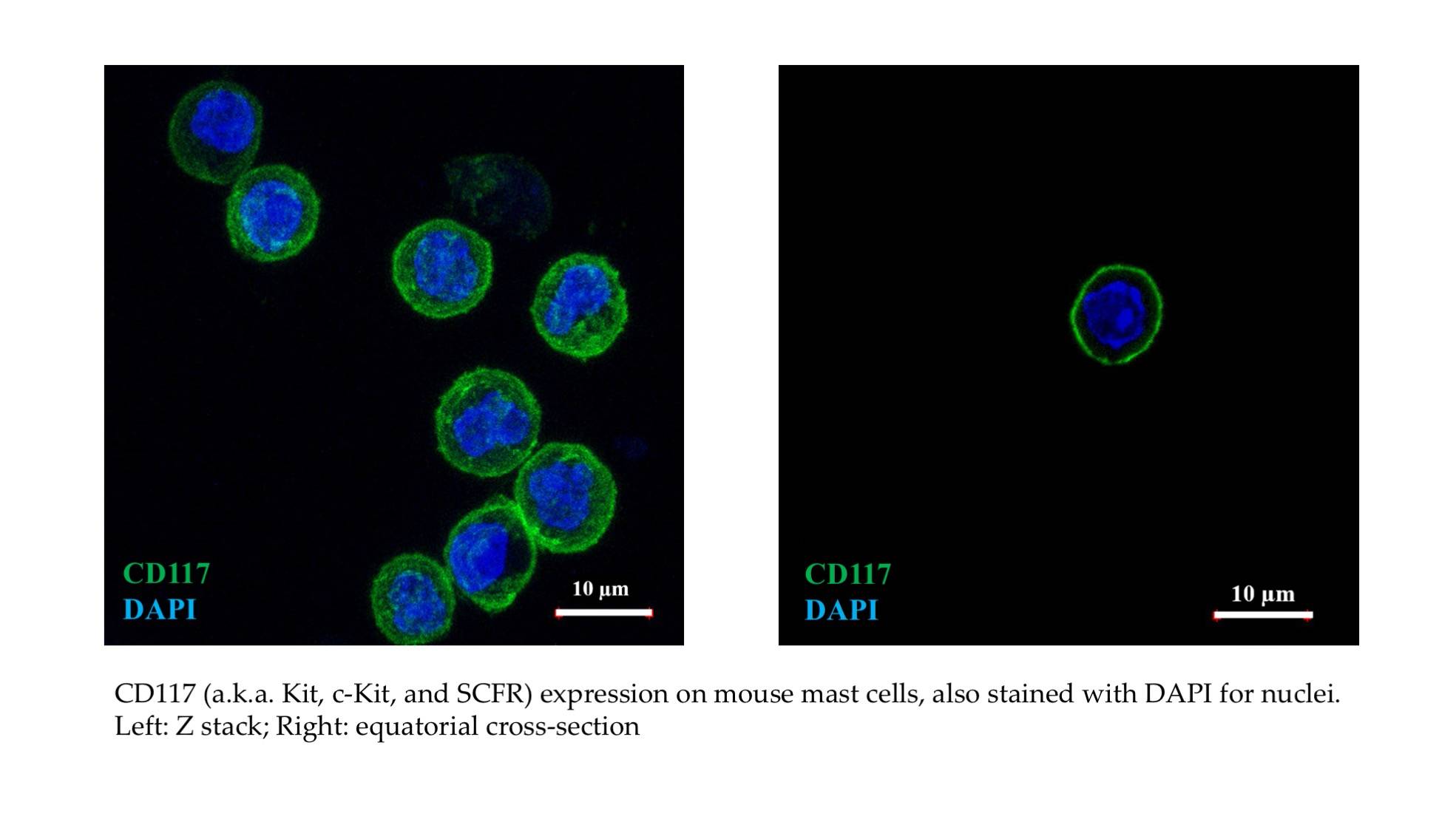 Mast Cells CD117
