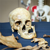 Skull bone among other skeletal remains